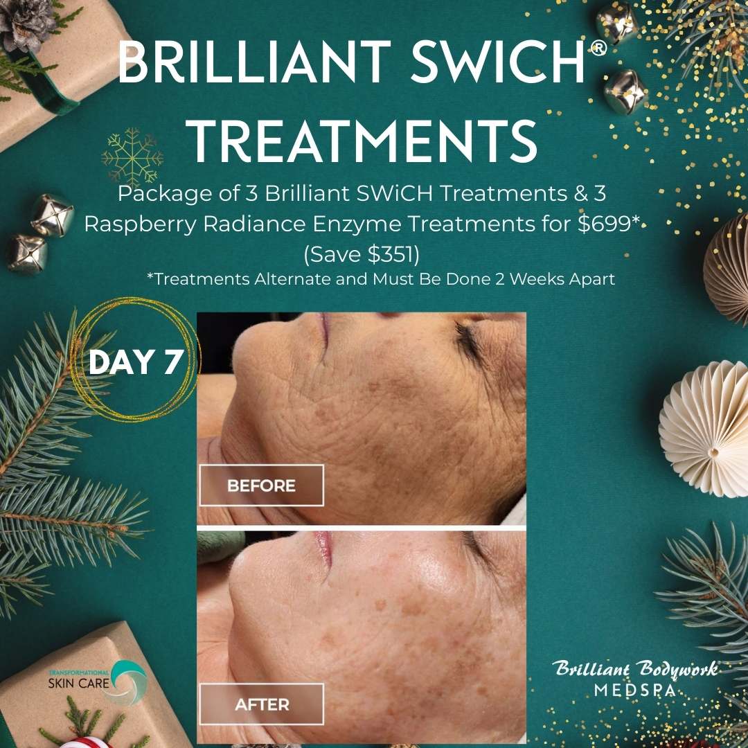 Day 7 - Botox offer