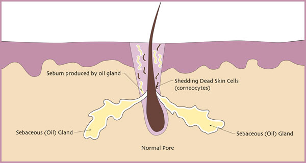 normal-pore.jpg