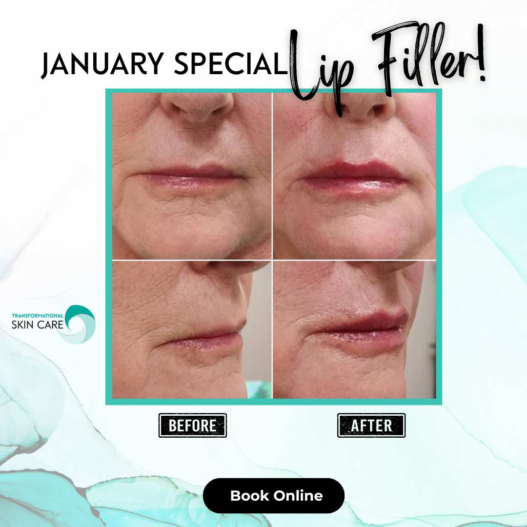 Book your Lip Filler appointment today.