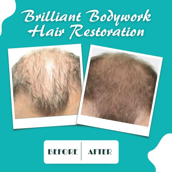 Click this image to book your Brilliant Bodywork Hair Restoration Appointment for July specials