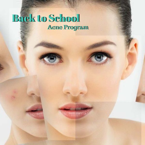 Click this image to get your Back to School Acne Program Scheduled.